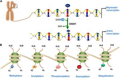 Epigenetic modification in Parkinson’s disease